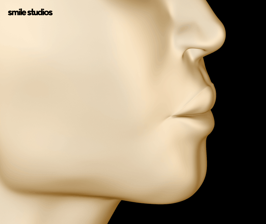 돌출입교정가격 기준 및 효과, 방법 파헤치기 관련 이미지 2