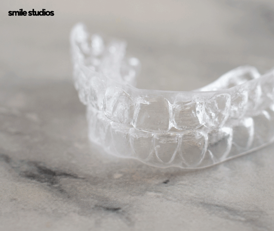 투명교정후기 알아본다면 함께 꼭 확인해야 할 2가지 관련 이미지 8