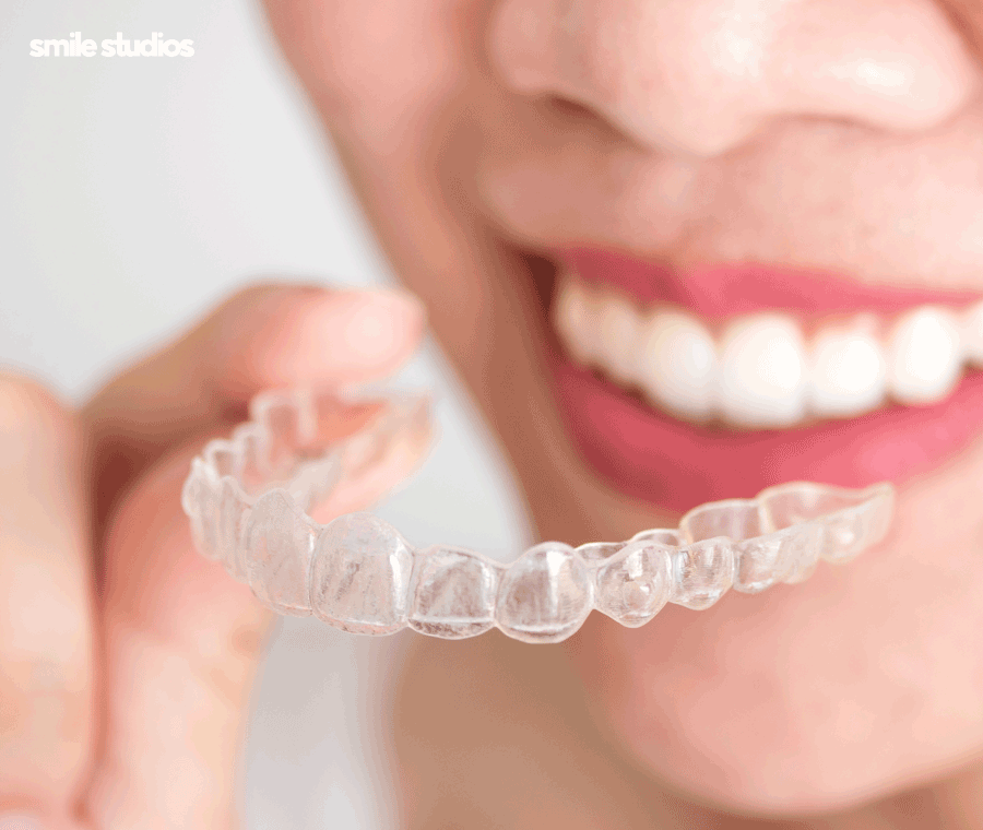 인비절라인 세척 올바른 관리 방법 확인하세요! 관련 이미지 7