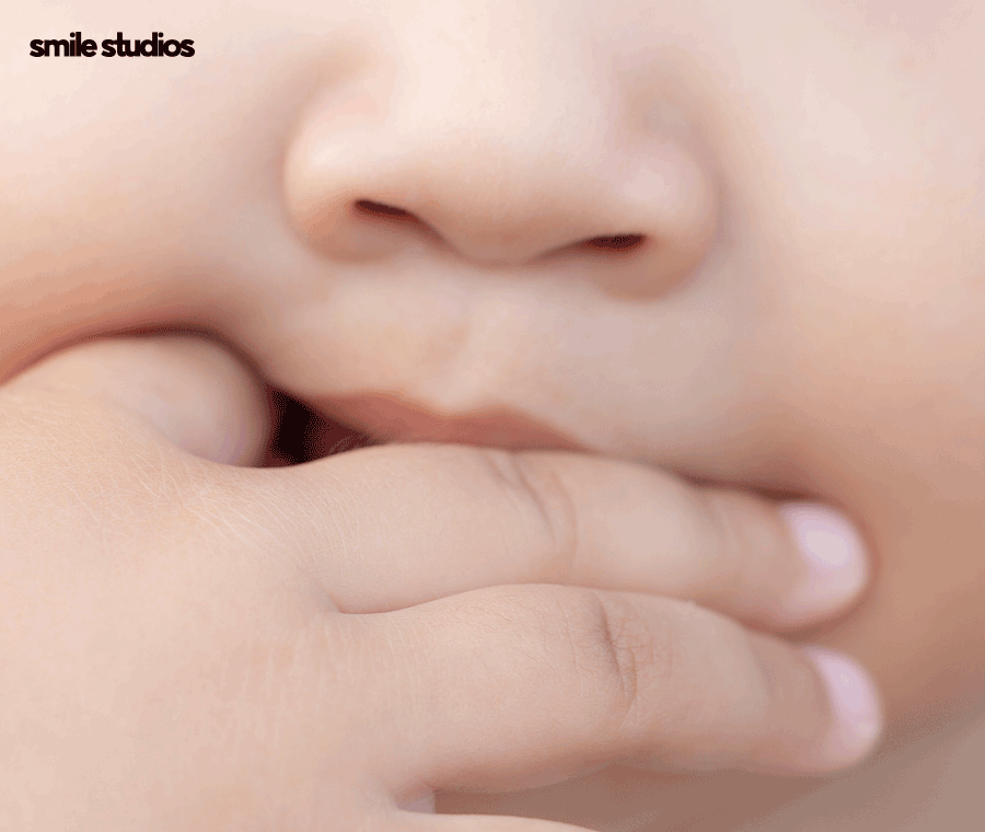 옥니 교정 필요한 이유, 발생 원인, 방법 파헤치기 관련 이미지 6