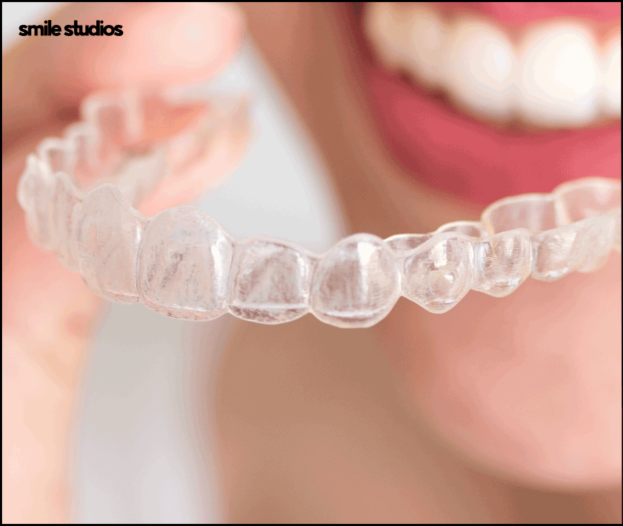 역삼역치과 인비절라인, 브라켓과 차이점 알아보기 관련 이미지 8