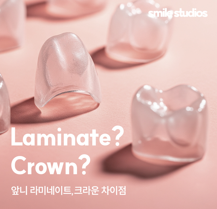 도산대로치과 앞니 라미네이트 크라운 차이점 관련 이미지 1