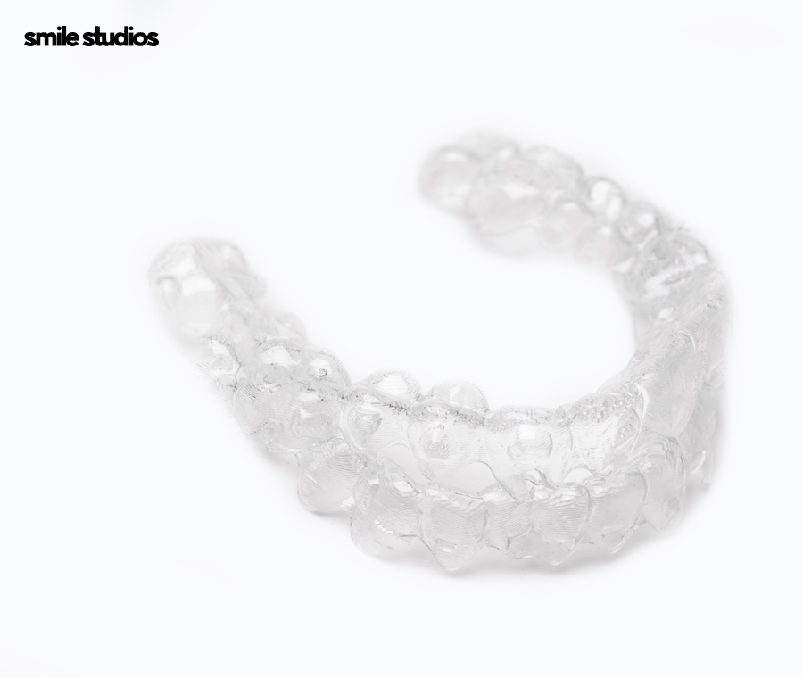 서울 논현동 치과 앞니 투명교정 장단점 총 정리 관련 이미지 10