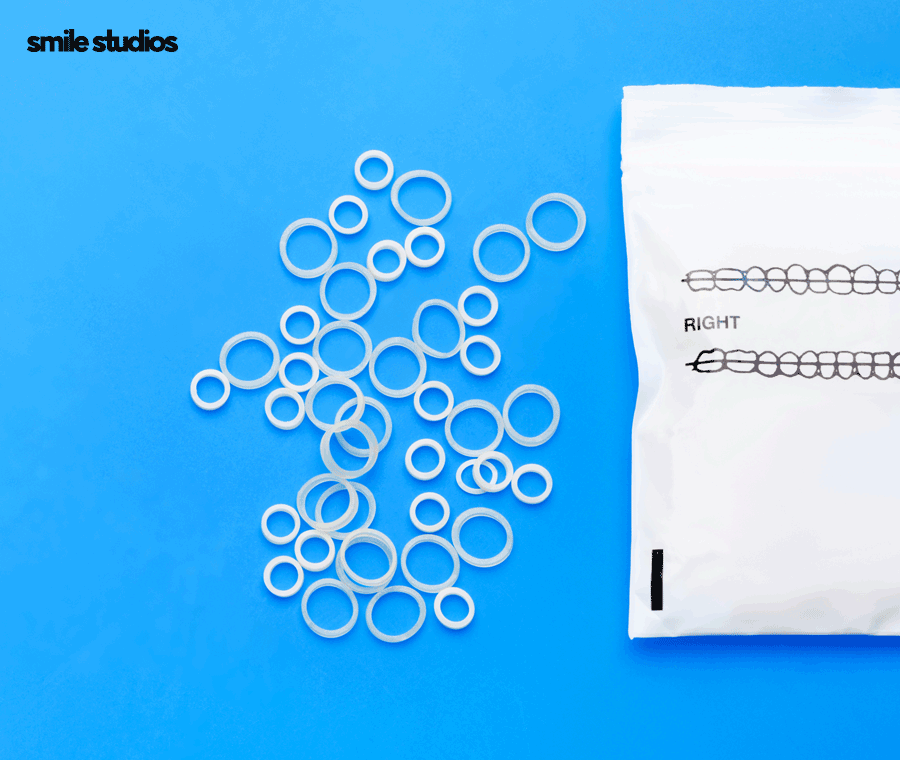 인비절라인 고무줄 착용해야 할까요? 기능 확인 관련 이미지 4