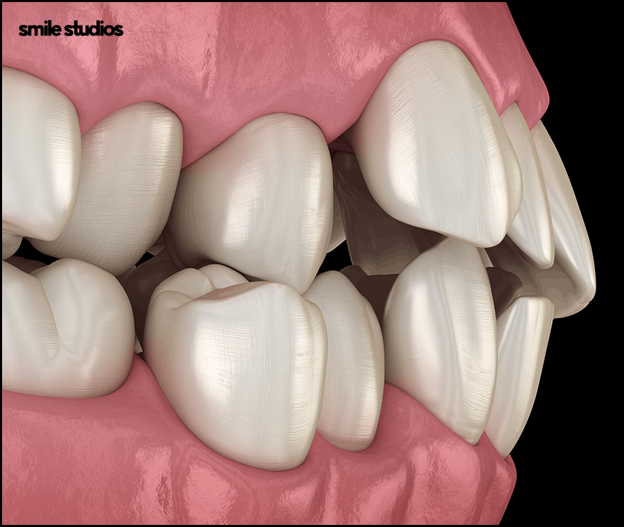 강남교정치과 선택 전 꼭 체크해야 하는 3가지 관련 이미지 3