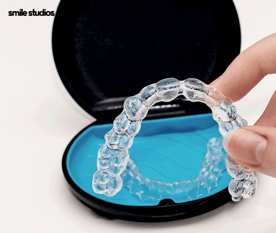 부정교합 교정기(투명) 종류 및 특징 알아보기 관련 이미지 4