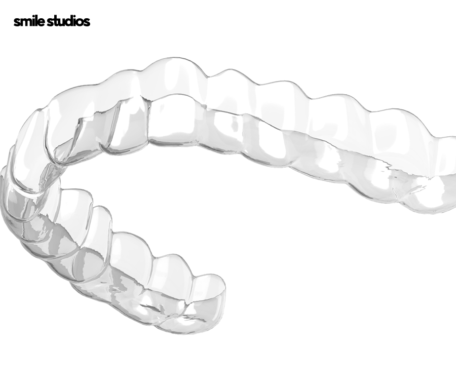 인비절라인 유지장치 착용 기간, 주의사항 알아보기 관련 이미지 2