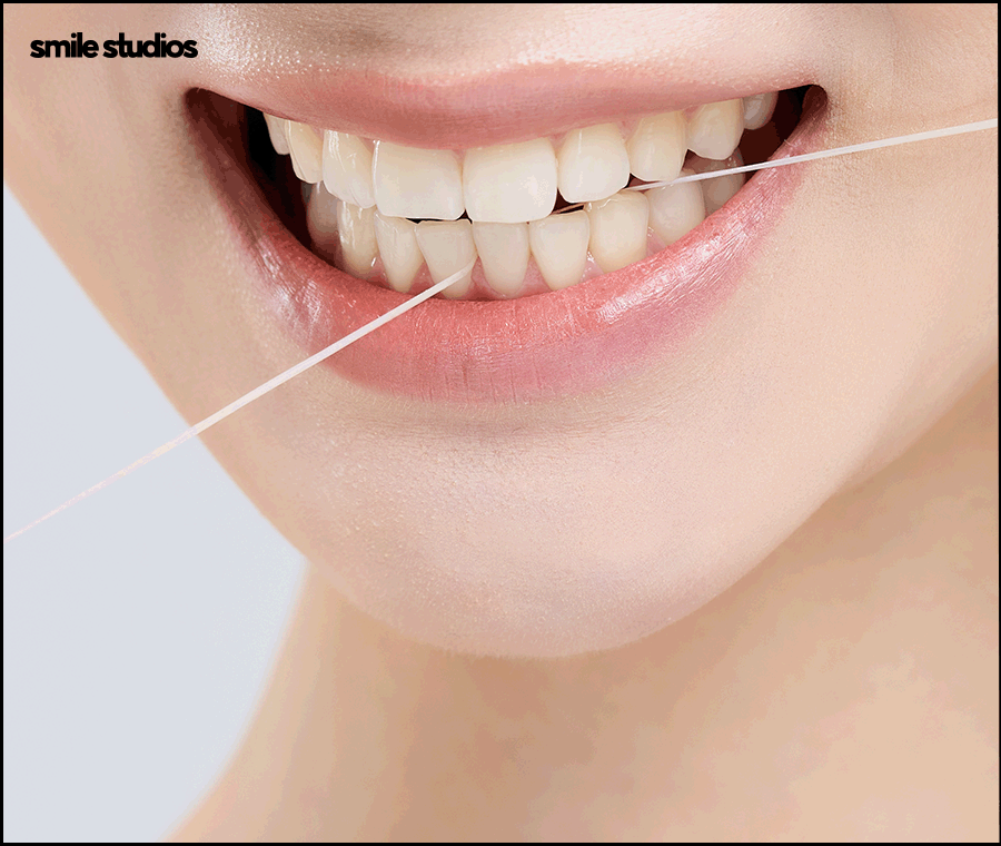 치경부마모증, 주저앉은 잇몸? 원인과 해결 방법 관련 이미지 9