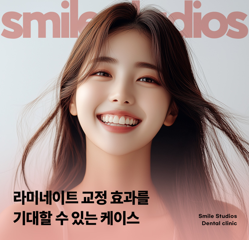 라미네이트 교정 효과를 기대할 수 있는 케이스는? 관련 이미지 1