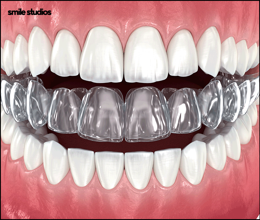 강남교정치과 선택 전 꼭 체크해야 하는 3가지 관련 이미지 5