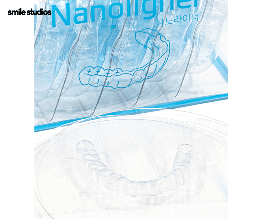 부정교합 치아교정 비용 다른 이유, 함께 체크할 사항 관련 이미지 4