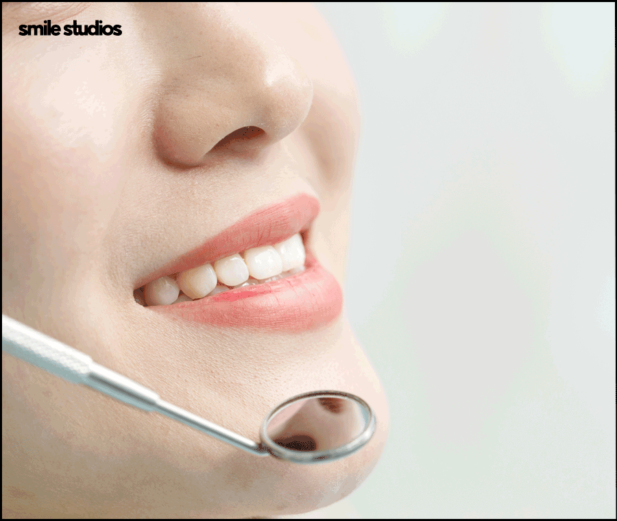 신논현역치과, 라미네이트 시술 전 꼭 확인할 핵심 2가지 관련 이미지 2