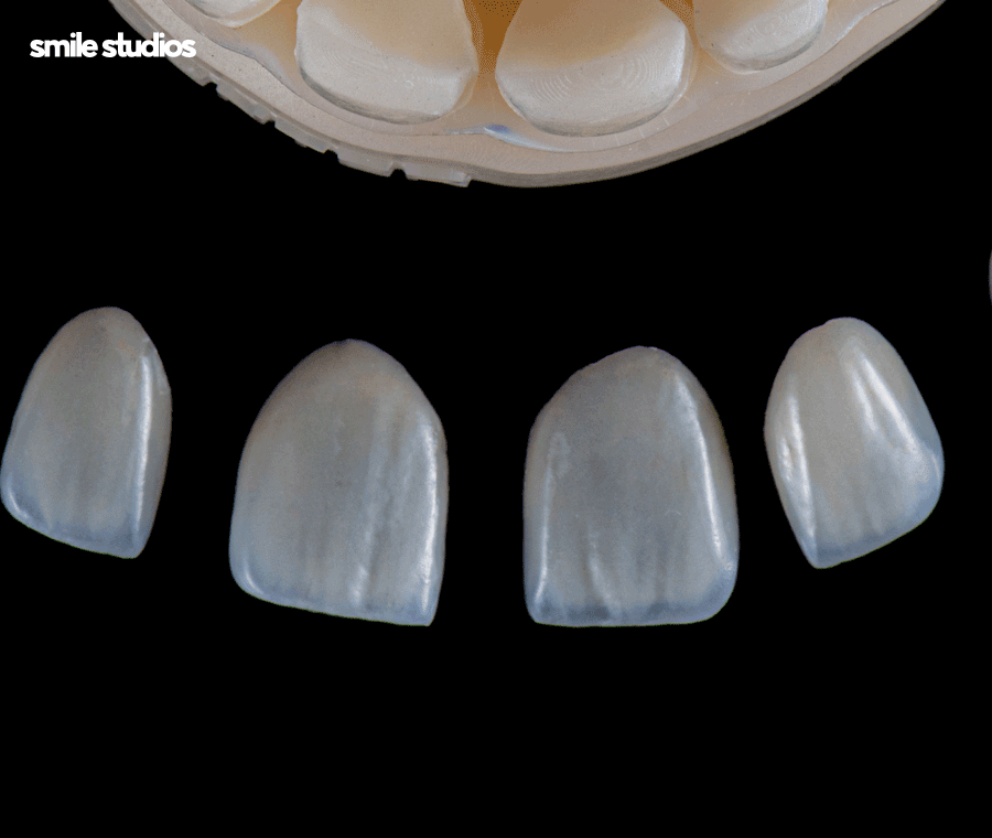 라미네이트 빠짐, 재부착 가능할까요? +대처방법 관련 이미지 8