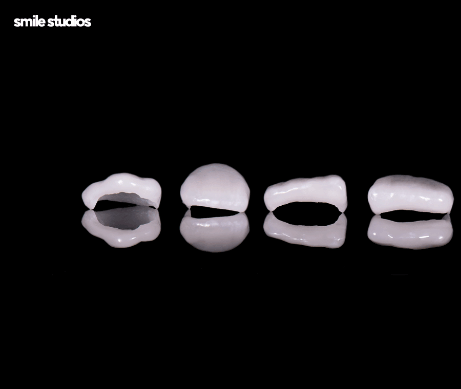 블랙트라이앵글 치료 적합한 방법 알아보기 관련 이미지 9