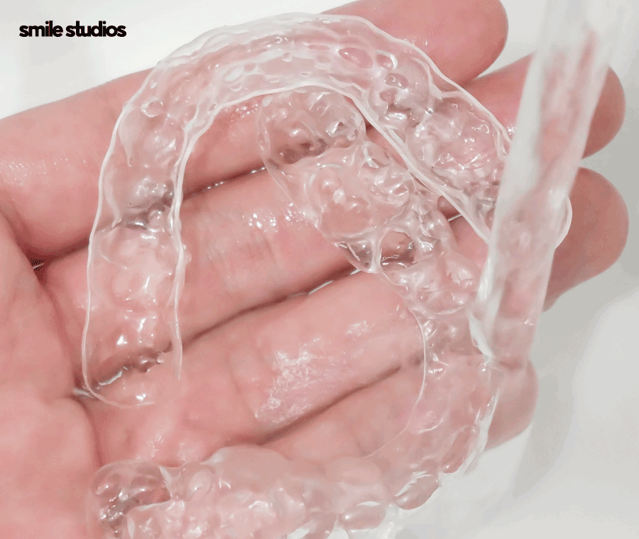 투명 교정기 세척 올바른 관리 방법 A to Z 관련 이미지 3