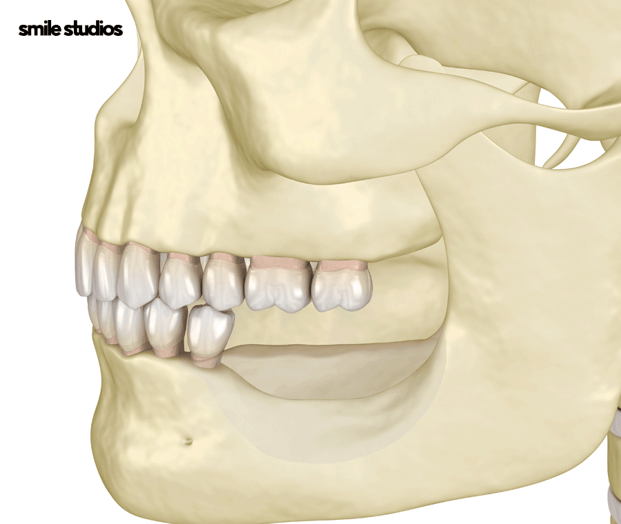 부정교합 치아교정 비용 다른 이유, 함께 체크할 사항 관련 이미지 7