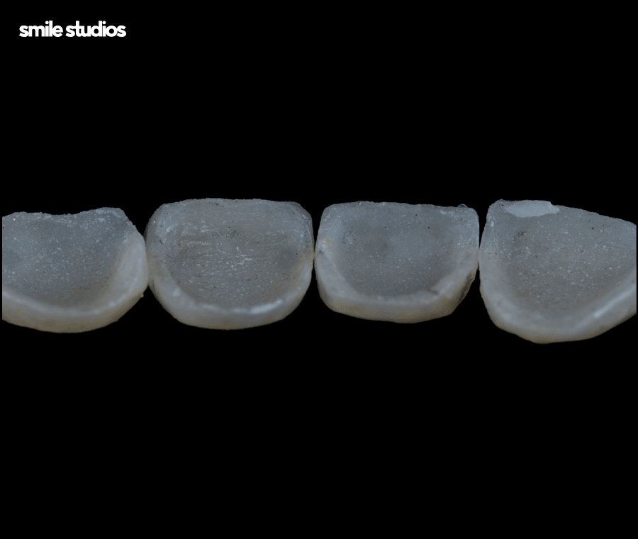 라미네이트 변색, 발생하는 이유, 시점, 대처 방법 관련 이미지 6