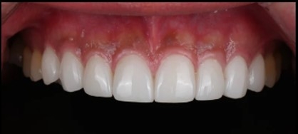 강남라미네이트 혹시 아직도 관련 이미지 9