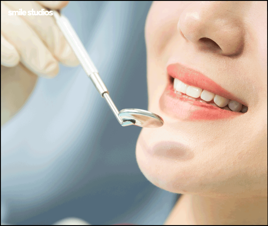 앞니 벌어짐 교정? 라미네이트? 케이스별 추천 방법 관련 이미지 8