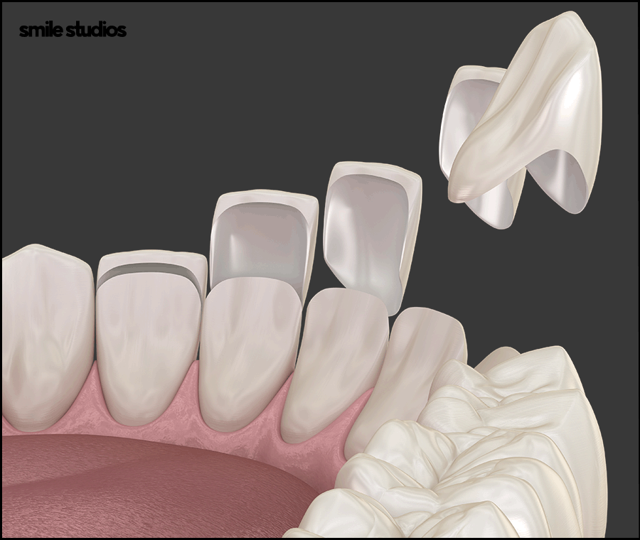 라미네이트 코팅이란? 원리와 기대 효과, 추천 대상 관련 이미지 3