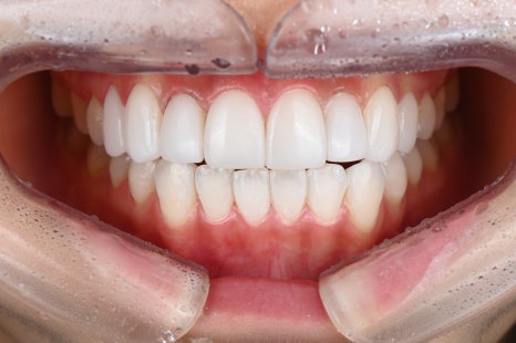 스마일스튜디오치과는 관련 이미지 8