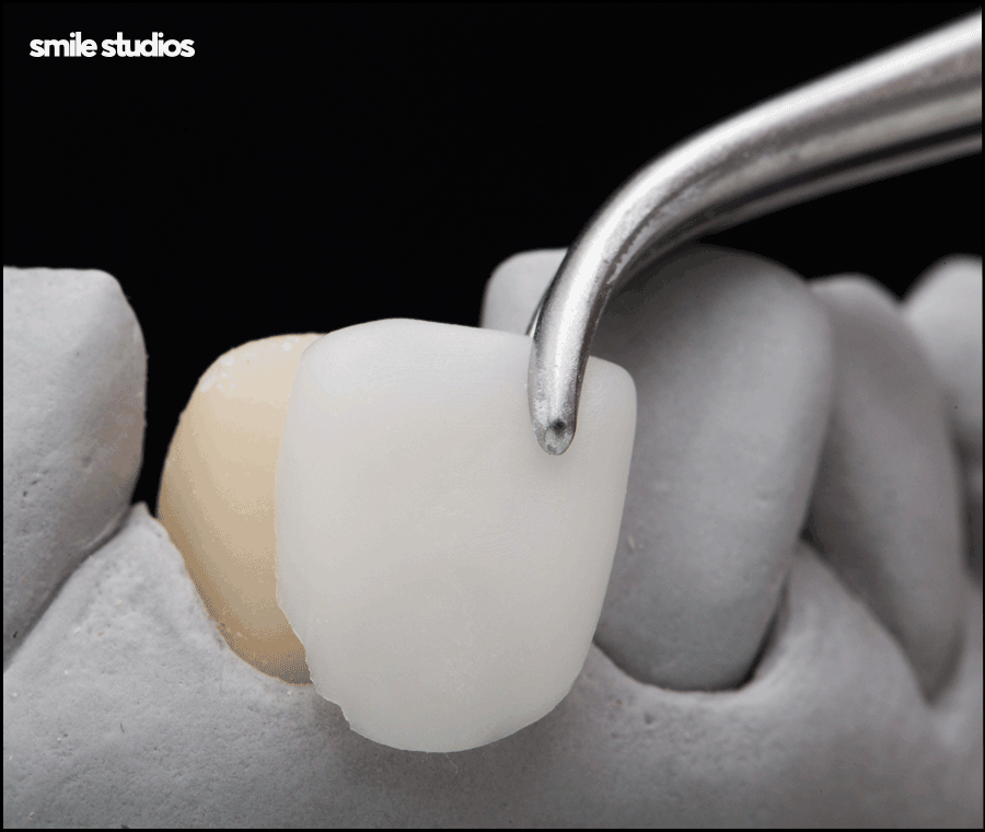 라미네이트가격 및 달라지는 기준, 확인하기 관련 이미지 3