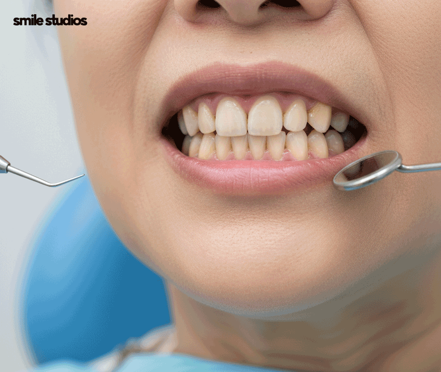 부정교합 치아교정 비용 다른 이유, 함께 체크할 사항 관련 이미지 8