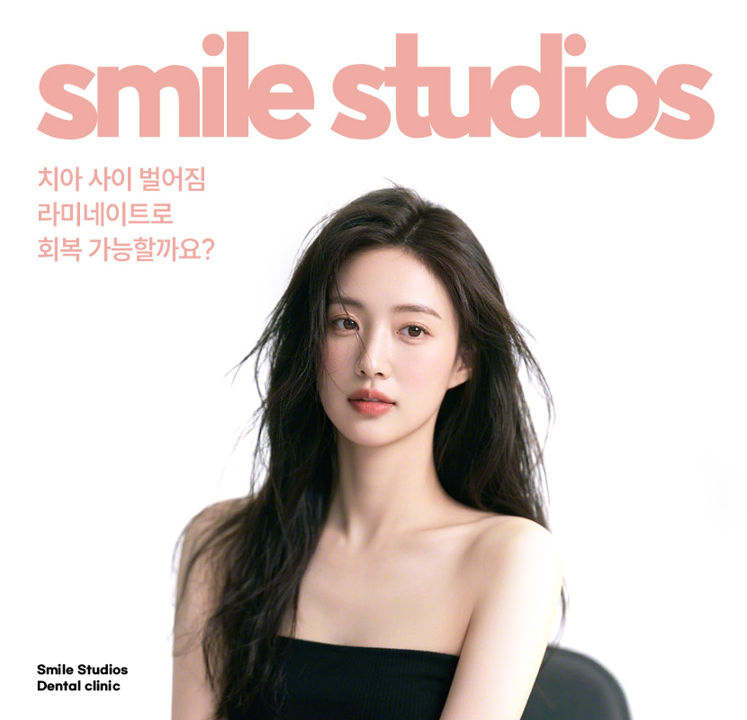 치아사이 벌어짐 가지런한 앞니 만드는 Tip 관련 이미지 1