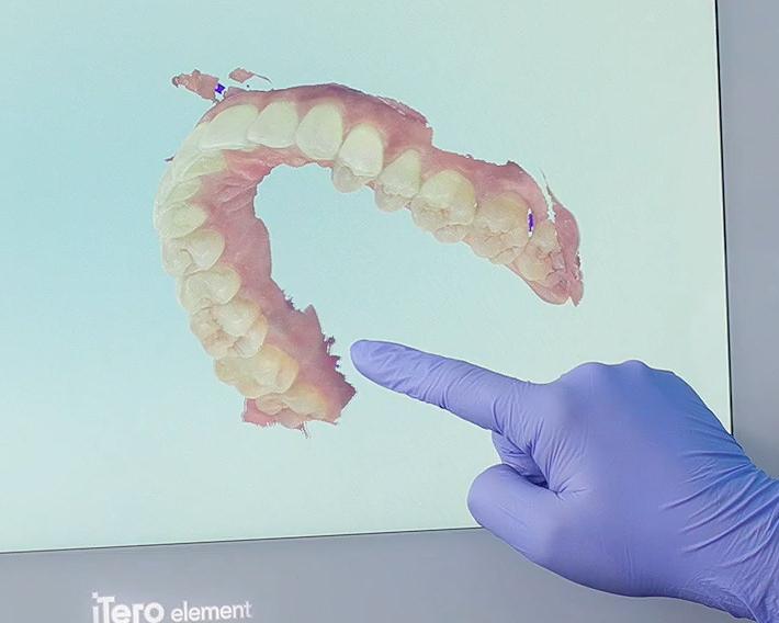 임플란트 하기 전 알아보아야 할 것. 관련 이미지 8