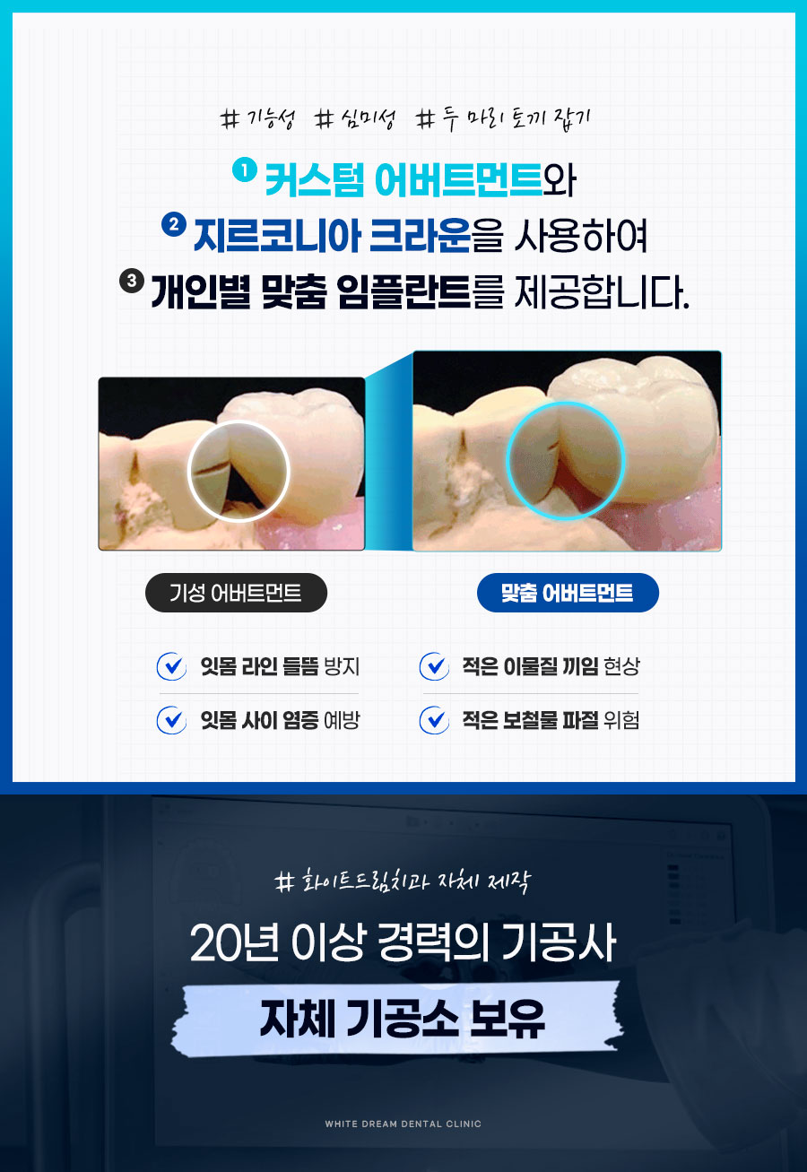 임플란트 하기 전 알아보아야 할 것. 관련 이미지 23