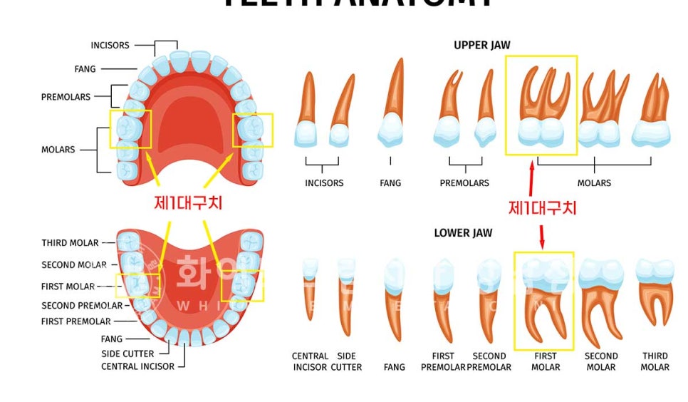 임플란트 개수를 줄일 수 있는 방법? (+치아를 발치한지 오래되었나요?) 관련 이미지 8