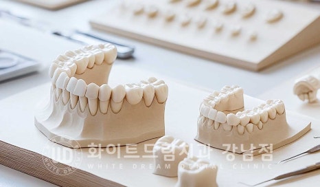 깨진앞니 라미네이트 / 깨지고 누렇게 변한 앞니는? 원데이 라미네이트 치료 사례 관련 이미지 8