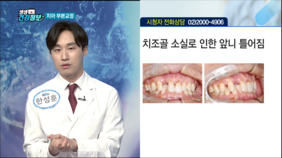 [매일경제TV 생생건강정보] 교정과 한성훈원장님 출연영상 관련 이미지 3