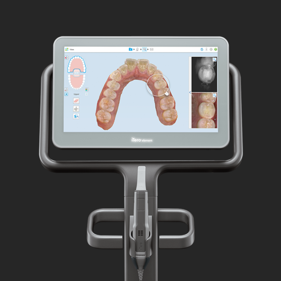 투명교정 시작하기전에 관련 이미지 9