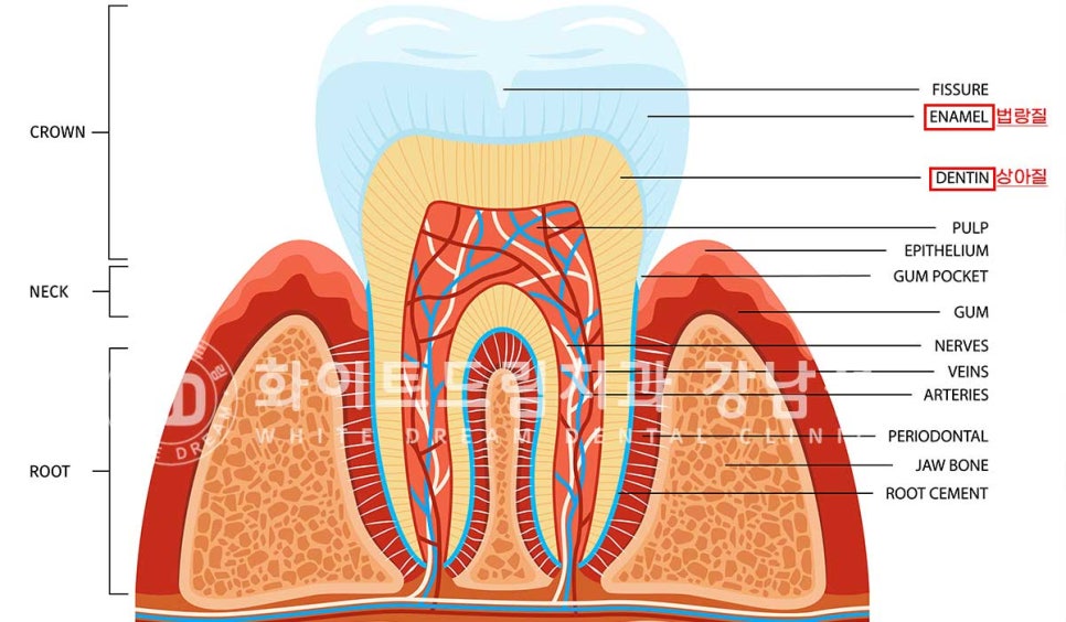 틀어진 치아 라미네이트, 틀어지고 색이 다른 앞니가 고민이에요. 관련 이미지 2