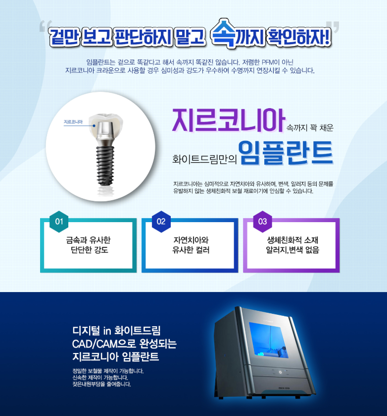 임플란트 보철물 어느것으로 해야 할까요? PFM? 지르코니아? 관련 이미지 1