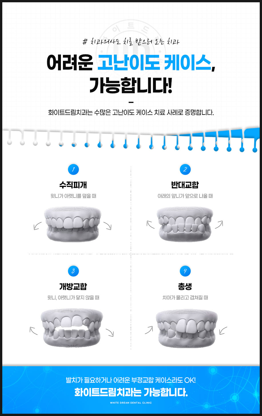 투명교정 시작하기전에 관련 이미지 3