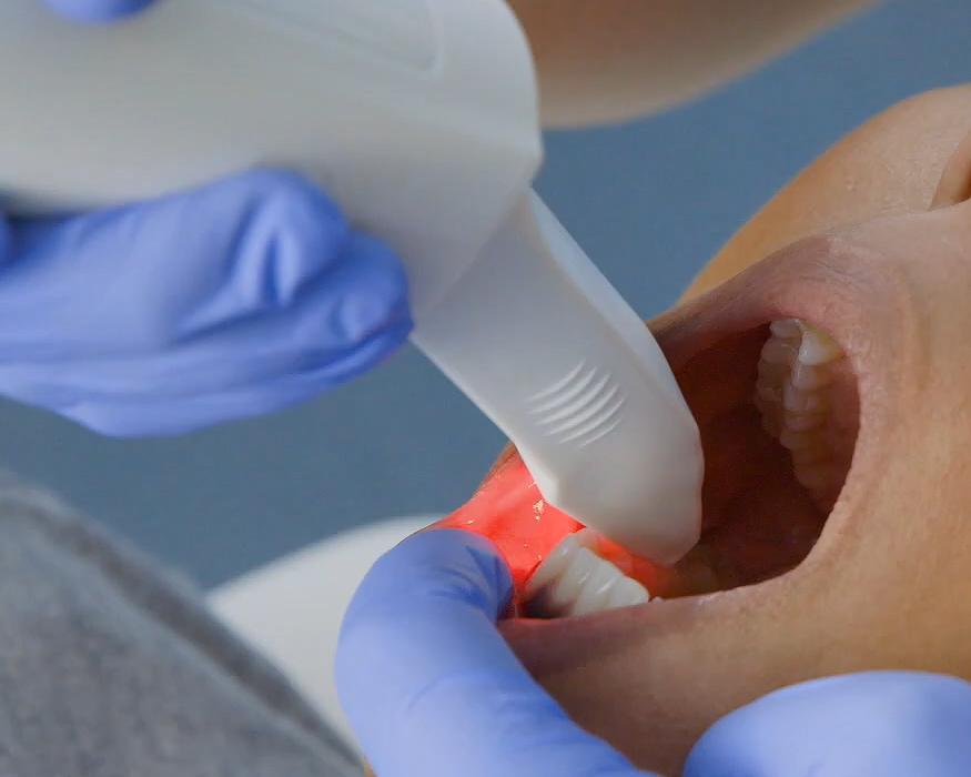 임플란트 하기 전 알아보아야 할 것. 관련 이미지 6