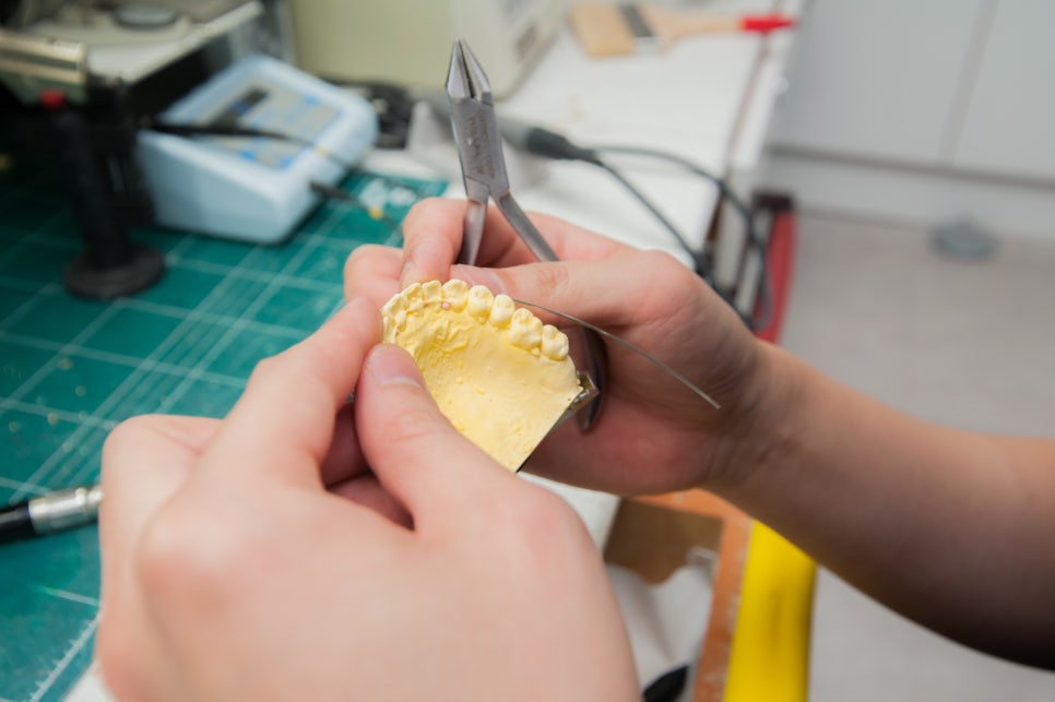 치아교정, 꼭 해야 한다면 미리 알아 두자. 관련 이미지 32