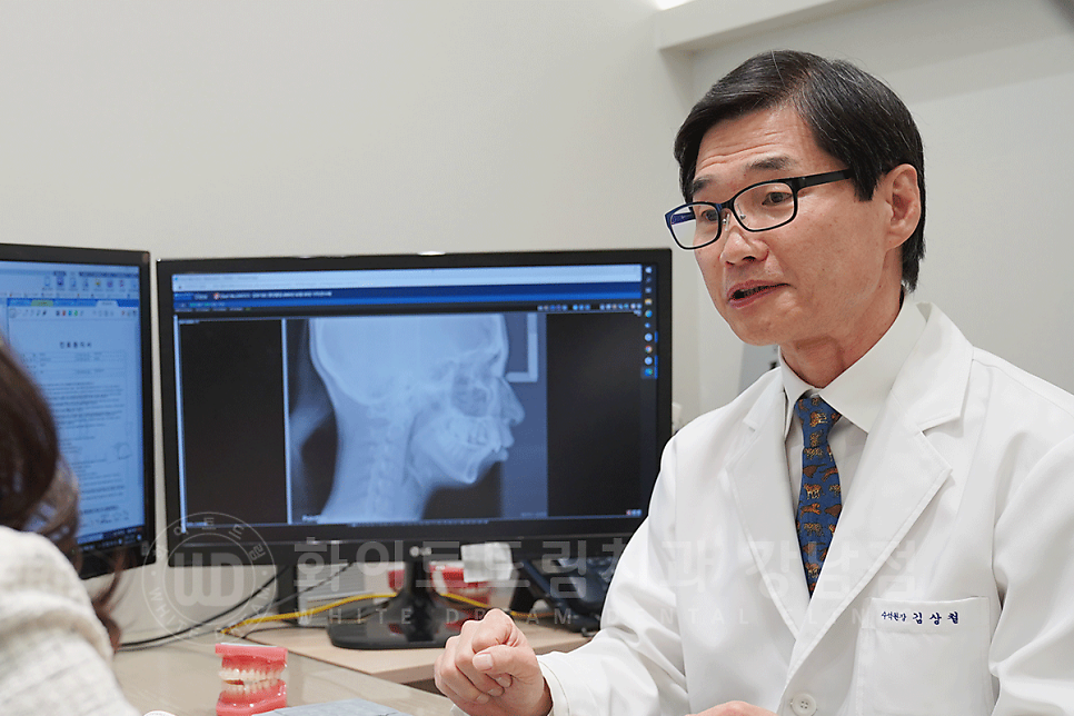 강남 덧니 비발치교정 / 임플란트와 치아교정 동시 진행 case 리뷰. 관련 이미지 1