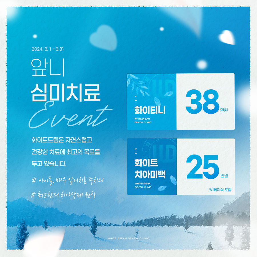 라미네이트 치료에 대해 알아보면? 관련 이미지 2