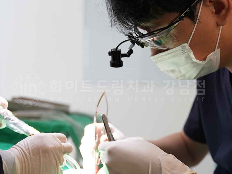 강남역 전악 임플란트 "치아가 흔들리고 빠져요!" 치주염 임플란트 치료 관련 이미지 1