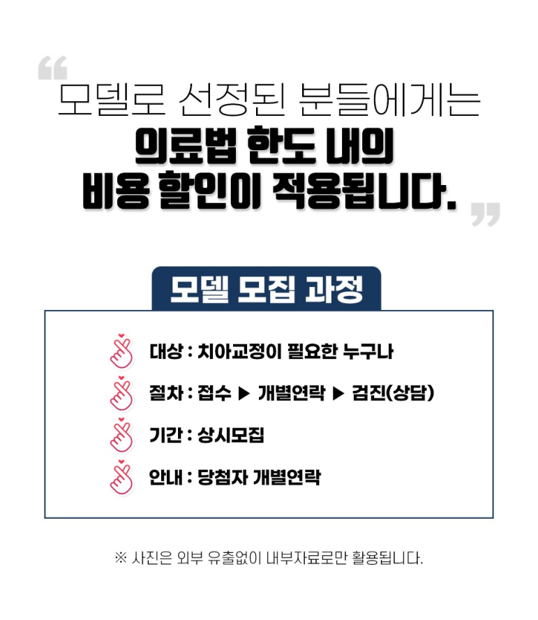 얼굴공개없는 치아교정 모델 모집 관련 이미지 3