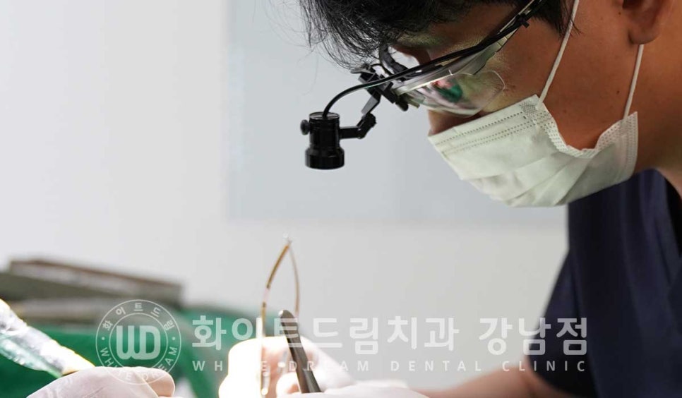 발치 즉시 임플란트 "내원 당일 발치 후 바로 임플란트 식립!" 관련 이미지 15