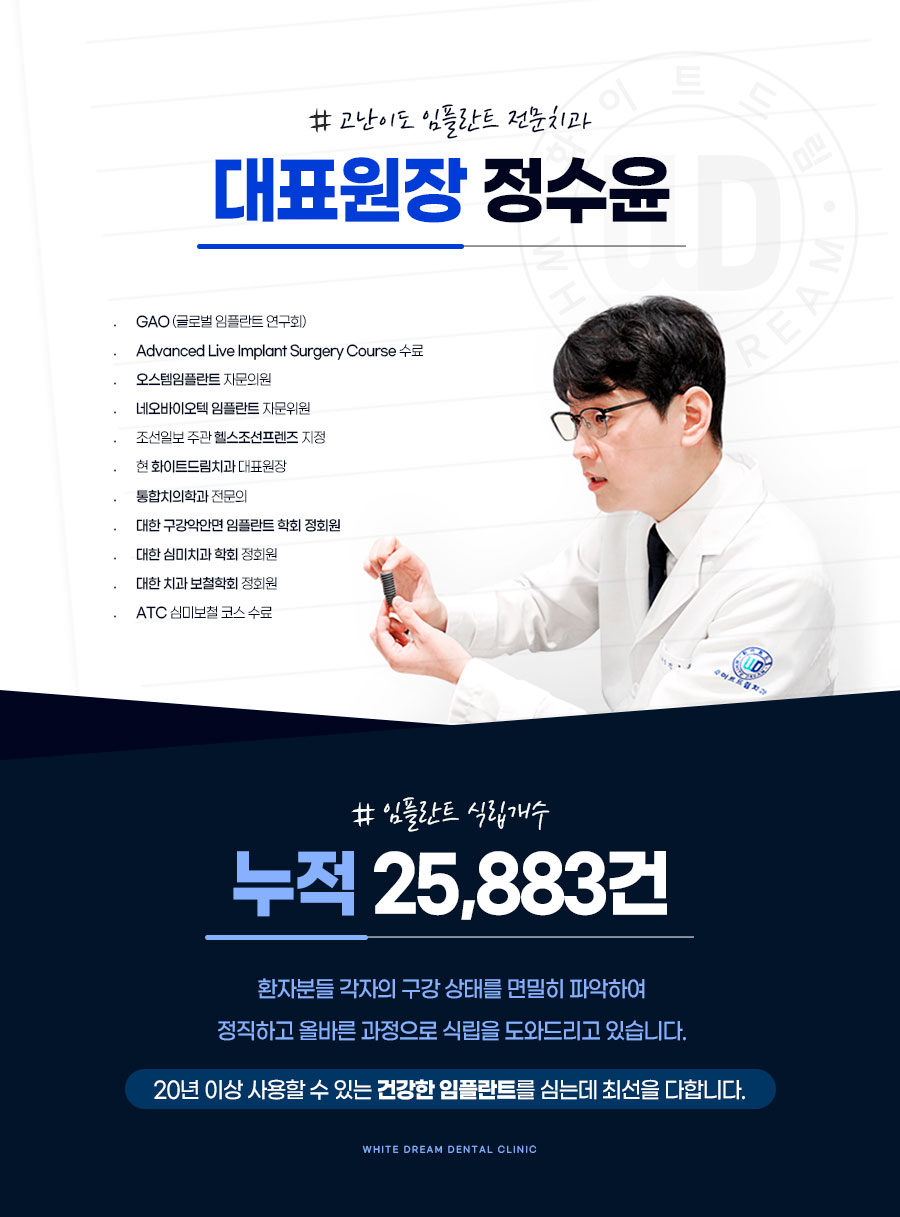 임플란트 하기 전 알아보아야 할 것. 관련 이미지 3