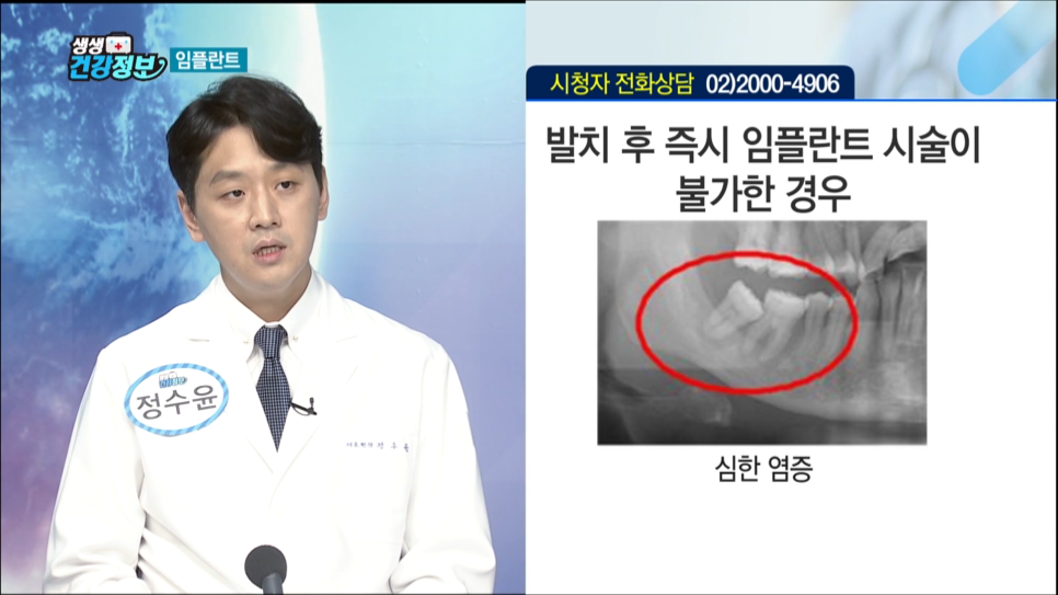 [매일경제TV 생생건강정보] 정수윤 대표원장  출연영상 관련 이미지 3