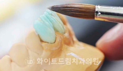 강남역 잇몸성형, 라미네이트와 흔히 동반되는 관련 이미지 9