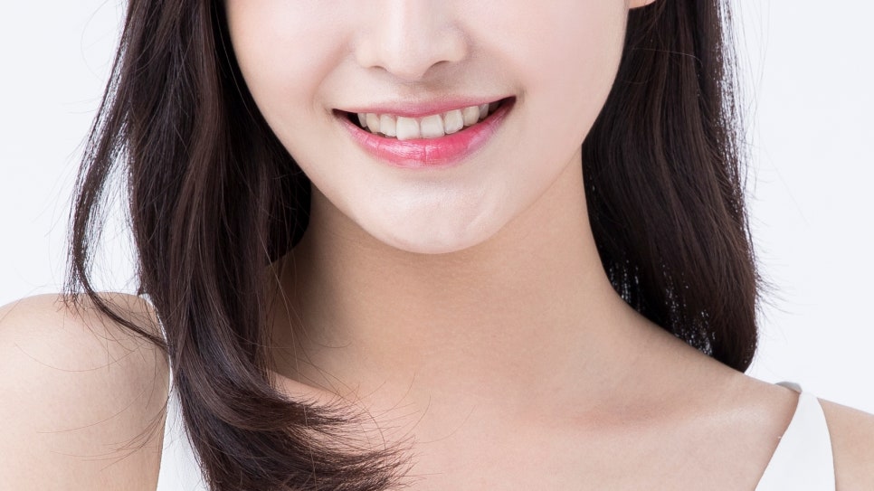 치아교정, 꼭 해야 한다면 미리 알아 두자. 관련 이미지 34