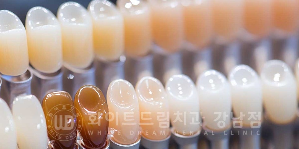 역삼역 왜소치치료 / 치아 하나가 너무 작아요. 왜소치 라미네이트 잘하는 치과 관련 이미지 9