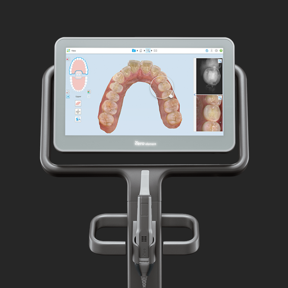 치아교정, 꼭 해야 한다면 미리 알아 두자. 관련 이미지 19